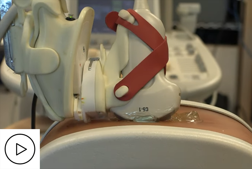 3DLIVUS image acquisition